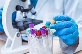 Examenes Médicos Generales en Laboratorios Correa, Exámenes del COVID 19, a B/20.00